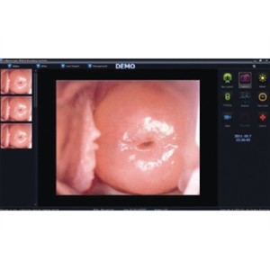 SOFTWARE COLPOSCOPIA per 29624, 29625, 29628