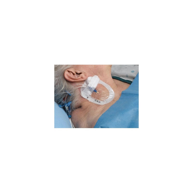 TEGADERM 3M I.V. ADVANCED 8,5x11,5 cm per linee centrali