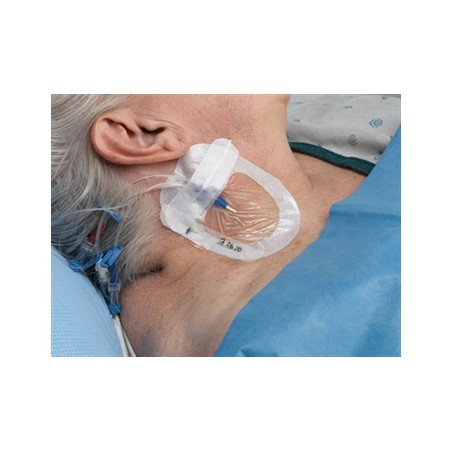 TEGADERM 3M I.V. ADVANCED 8,5x11,5 cm per linee centrali