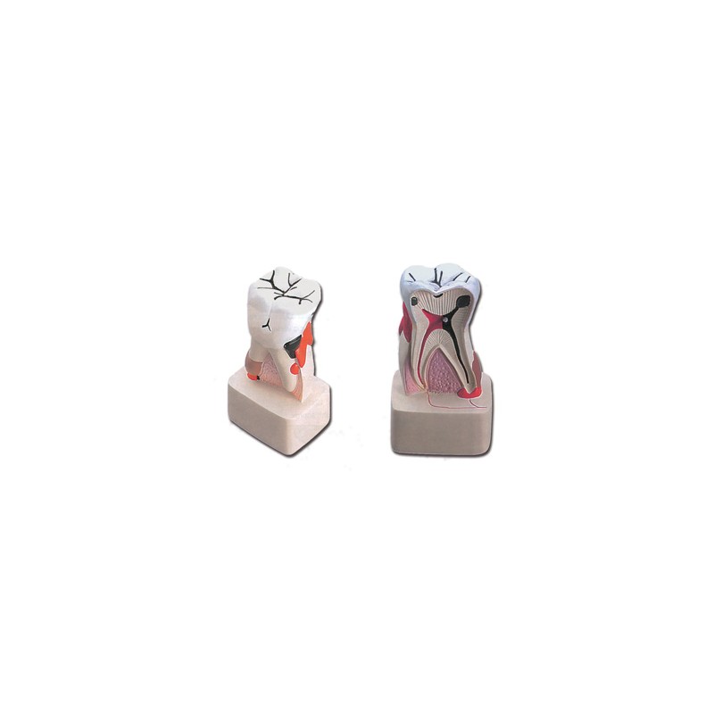 MODELLO PATOLOGIA DENTALE